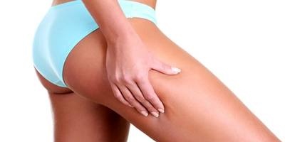 Cellulite and anti-cellulite treatments